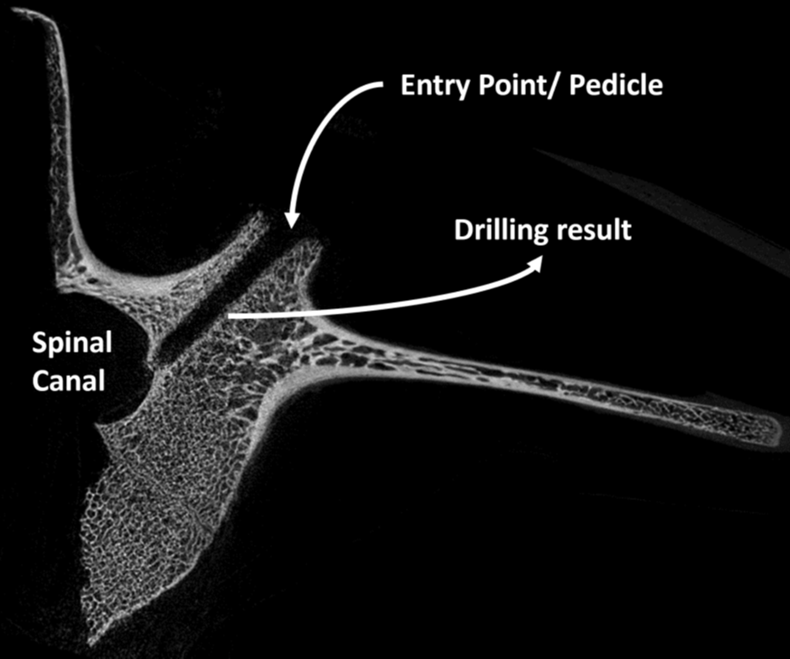 drilling vertebra robot